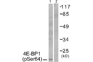 Western blot analysis of extracts from Jurkat cells, treated with Insulin (0. (eIF4EBP1 antibody  (pSer64))