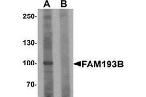 Western blot analysis of FAM193B in Jurkat cell lysate with FAM193B Antibody  at 1 ug/ml in (A) the absence and (B) the presence of blocking peptide. (FAM193B antibody  (N-Term))