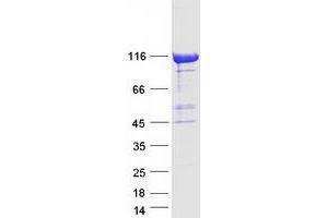 Validation with Western Blot