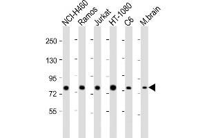 All lanes : Anti-GARS Antibody (C-term) at 1:2000 dilution Lane 1: NCI- whole cell lysate Lane 2: Ramos whole cell lysate Lane 3: Jurkat whole cell lysate Lane 4: HT-1080 whole cell lysate Lane 5: C6 whole cell lysate Lane 6: mouse brain lysate Lysates/proteins at 20 μg per lane. (GARS antibody  (C-Term))