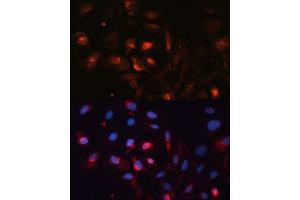 Immunofluorescence analysis of U2OS cells using  antibody (ABIN6133586, ABIN6137050, ABIN6137052 and ABIN6225252) at dilution of 1:100. (Aquaporin 5 antibody  (AA 150-250))