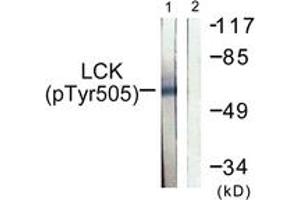 Western blot analysis of extracts from Jurkat cells, using Lck (Phospho-Tyr505) Antibody. (LCK antibody  (pTyr505))