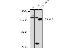 Western blot analysis of extracts of various cell lines, using NUP153 Rabbit mAb (ABIN1512527, ABIN3023298, ABIN3023299 and ABIN7101477) at 1:1000 dilution. (NUP153 antibody)