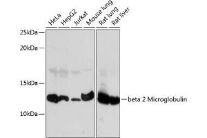 Western blot analysis of extracts of various cell lines, using beta 2 Microglobulin Rabbit mAb (ABIN7265876) at 1:1000 dilution.