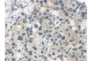 Immunohistochemistry (IHC) image for anti-serpin Peptidase Inhibitor, Clade B (Ovalbumin), Member 4 (SERPINB4) (AA 38-215) antibody (ABIN5014346)
