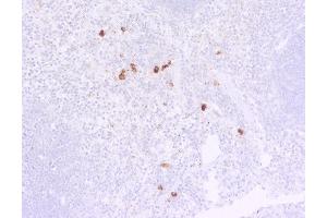 Indirect immunostaining of PFA fixed, paraffin embedded mouse spleen section (dilution 1 : 50, 1h incubation). (Rat anti-Mouse IgG lambda (Light Chain) Antibody)