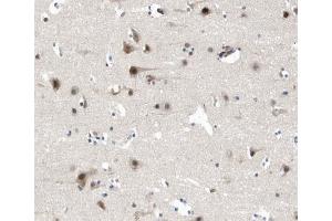 Immunohistochemistry (IHC) image for anti-Discs, Large Homolog 4 (Drosophila) (DLG4) (C-Term) antibody (ABIN6264460)