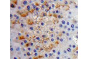 IHC-P analysis of liver tissue, with DAB staining. (IL17RC antibody  (AA 257-477))