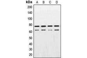 Western blot analysis of Lamin A/C expression in A431 (A), HeLa (B), NIH3T3 (C), PC12 (D) whole cell lysates. (Lamin A/C antibody  (Center))
