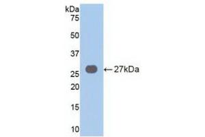 Detection of Recombinant VAV3, Human using Polyclonal Antibody to Vav 3 Oncogene (VAV3) (VAV3 antibody  (AA 183-380))