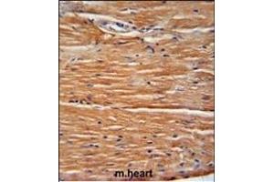 GIT1 Antibody (Center) (ABIN6243000 and ABIN6578993) immunohistochemistry analysis in formalin fixed and paraffin embedded mouse heart tissue followed by peroxidase conjugation of the secondary antibody and DAB staining. (GIT1 antibody  (AA 485-512))