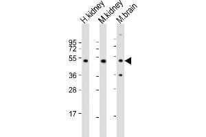 All lanes : Anti-NDUFV1 Antibody (N-term) at 1:2000 dilution Lane 1: human kidney lysate Lane 2: mouse kidney lysate Lane 3: mouse brain lysate Lysates/proteins at 20 μg per lane. (NDUFV1 antibody  (N-Term))