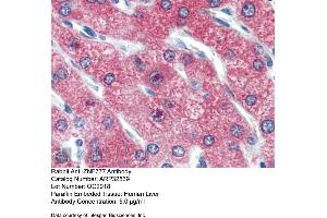 Immunohistochemistry with Human Liver cell lysate tissue at an antibody concentration of 5. (ZNF777 antibody  (Middle Region))