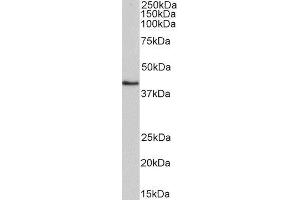 ABIN4902659 (0. (HMBS antibody)