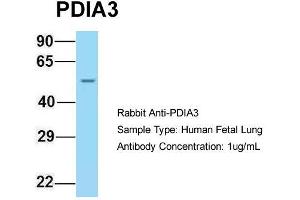 Host: Rabbit  Target Name: PDIA3  Sample Tissue: Human Fetal Lung  Antibody Dilution: 1. (PDIA3 antibody  (C-Term))