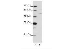 Image no. 2 for anti-Heterogeneous Nuclear Ribonucleoprotein K (HNRNPK) (N-Term) antibody (ABIN6736200) (HNRNPK antibody  (N-Term))
