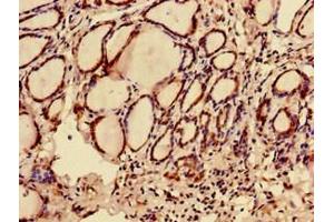 Immunohistochemistry of paraffin-embedded human thyroid tissue using ABIN7174723 at dilution of 1:100 (C12orf43 antibody  (AA 1-263))