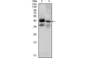 Western blot analysis using EPCAM mouse mAb against HTC116 (1) and T47D (2) cell lysate. (EpCAM antibody)