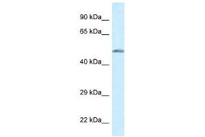 Western Blot showing GCK antibody used at a concentration of 1 ug/ml against COLO205 Cell Lysate (GCK antibody  (N-Term))