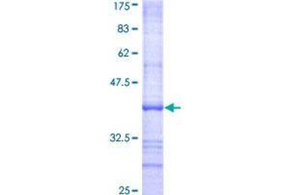 EIF2AK1 Protein (AA 81-180) (GST tag)