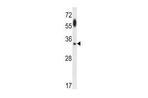 ATG5 Antibody (ABIN650657 and ABIN2849633) western blot analysis in uterus tumor cell line lysates (35 μg/lane).