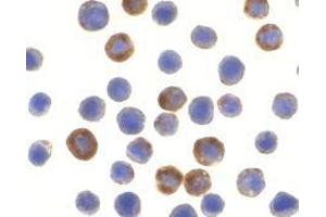 Immunocytochemistry of ILP-2 in HepG2 cells with AP30430PU-N ILP-2 antibody at 10 μg/ml. (ILP-2 antibody)
