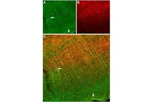 Expression of SSTR2 in mouse cortex - Immunohistochemical staining of frozen mouse cortex sections using Anti-Somatostatin Receptor Type 2 (extracellular) Antibody (ABIN7043765, ABIN7045268 and ABIN7045269), (1:100). (SSTR2 antibody  (Extracellular, N-Term))