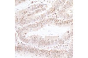 Immunohistochemistry (IHC) image for anti-Nuclear Factor of Activated T-Cells, Cytoplasmic, Calcineurin-Dependent 4 (NFATC4) (AA 852-902) antibody (ABIN7453742)