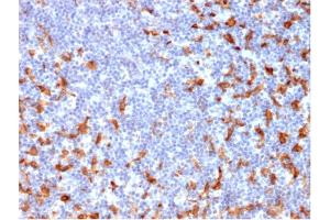 Immunohistochemistry (IHC) image for anti-CD163 (CD163) (AA 43-196) antibody (ABIN6941115)