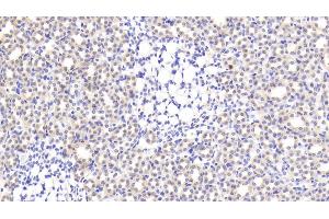 Detection of CNR1 in Rat Kidney Tissue using Polyclonal Antibody to Cannabinoid Receptor 1, Brain (CNR1) (CNR1 antibody  (AA 1-117))