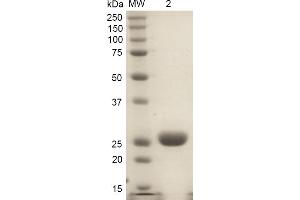 SDS-PAGE of ~32 kDa rat HO-1 protein (ABIN1686744, ABIN1686745 and ABIN1686746). (HMOX1 Protein (partial) (His tag))