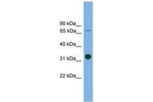 Image no. 1 for anti-Solute Carrier Family 5 (Low Affinity Glucose Cotransporter), Member 4 (SLC5A4) (AA 431-480) antibody (ABIN6744757) (SLC5A4 antibody  (AA 431-480))