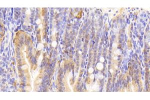 Detection of GAL2 in Mouse Colon Tissue using Polyclonal Antibody to Galectin 2 (GAL2) (Gallinacin-2 (GAL2) (AA 1-130) antibody)
