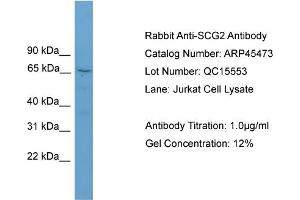 WB Suggested Anti-SCG2  Antibody Titration: 0.