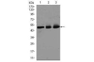 Image no. 5 for anti-E2F Transcription Factor 1 (E2F1) antibody (ABIN1491636) (E2F1 antibody)