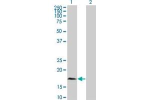 Western Blot analysis of PLA2G12A expression in transfected 293T cell line by PLA2G12A polyclonal antibody (A01). (PLA2G12A antibody  (AA 90-188))