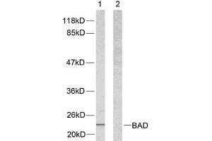 Western blot analysis of extracts from 293 cells using BAD (Ab-112) antibody (E021062). (BAD antibody)