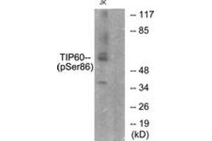 Western blot analysis of extracts from Jurkat cells, using TIP60 (Phospho-Ser86) Antibody. (KAT5 antibody  (pSer86))
