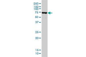 DDX41 monoclonal antibody (M01), clone 2F4 Western Blot analysis of DDX41 expression in Hela S3 NE .