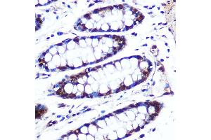 Immunohistochemistry of paraffin-embedded human colon using APIP Rabbit pAb (ABIN6131310, ABIN6136985, ABIN6136986 and ABIN6222909) at dilution of 1:100 (40x lens).