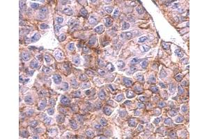 Immunohistochemistry (IHC) image for anti-Solute Carrier Family 20 (Phosphate Transporter), Member 1 (SLC20A1) antibody (ABIN2856026)