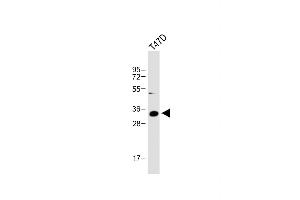 Anti-IGFBP2 Antibody (C-term) at 1:1000 dilution + T47D whole cell lysate Lysates/proteins at 20 μg per lane.