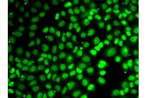 Immunofluorescence analysis of MCF7 cells using XPO5 antibody. (XPO5 antibody  (AA 925-1204))