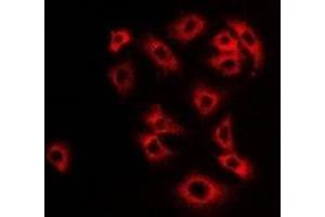 Immunofluorescent analysis of Monoamine Oxidase B staining in Hela cells. (Monoamine Oxidase B antibody)