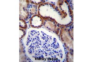 Immunohistochemistry (IHC) image for anti-Mitogen-Activated Protein Kinase Kinase Kinase 15 (MAP3K15) antibody (ABIN2996662)