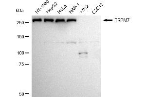 Western blotting analysis using TRPM7 antibody (ABIN7800608).