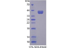 Image no. 1 for Aminoadipate Semialdehyde Phosphopantetheinyl Transferase (AA 1-309) protein (His tag) (ABIN6237779)