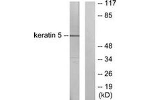Western blot analysis of extracts from HepG2 cells, using Keratin 5 Antibody. (Cytokeratin 5 antibody  (AA 541-590))