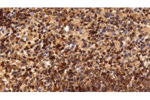 Immunohistochemistry (IHC) image for anti-Protein tyrosine Phosphatase, Receptor Type, C (PTPRC) (AA 193-575) antibody (ABIN7436852)