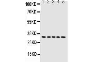 Anti-Caspase-6(P18) antibody, Western blotting Lane 1: MCF-7 Cell Lysate Lane 2: HELA Cell Lysate Lane 3: JURKAT Cell Lysate Lane 4: CEM Cell Lysate Lane 5: SW620 Cell Lysate